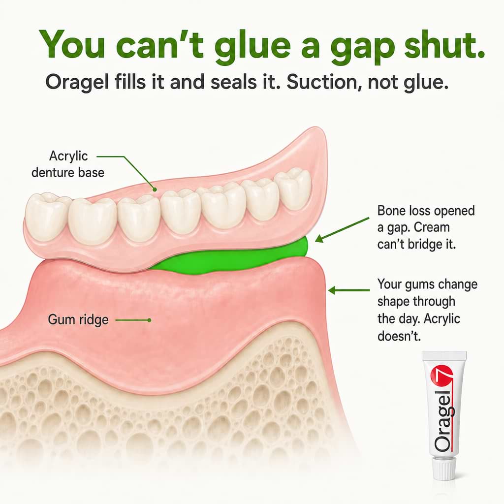 Oragel™ | Impedisce lo scivolamento della dentiera al 100% - Tenuta sicura per tutto il giorno